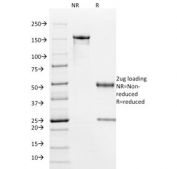 SDS-PAGE analysis of purified, BSA-free HPV-16 E6 antibody (clone HPV16/1295) as confirmation of integrity and purity.