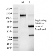 SDS-PAGE analysis of purified, BSA-free Phosphotyrosine antibody (clone PY265) as confirmation of integrity and purity.