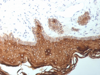 IHC staining of FFPE human skin with Cytokeratin 5/6/18 antibody (clone SPM267). HIER: boil tissue sections in pH 9 10mM Tris with 1mM EDTA for 10-20 min and allow to cool before testing.~
