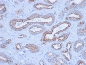 IHC staining of FFPE human prostate with Pan Cytokeratin antibody (clone PCK/3150). HIER: boil tissue sections in pH 9 10mM Tris with 1mM EDTA for 20 min and allow to cool before testing.