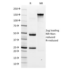 SDS-PAGE analysis of purified, BSA-free Helicobacter pylori antibody (clone HP/1335) as confirmation of integrity and purity.