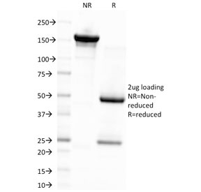 SDS-PAGE analysis of purified, BSA-free EBV antibody (clon