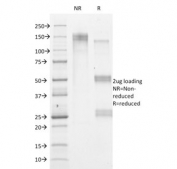 SDS-PAGE analysis of purified, BSA-free HSV1 antibody (clone HSVI/2095) as confirmation of integrity and purity.