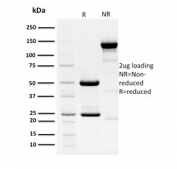 SDS-PAGE analysis of purified, BSA-free HPV16 E1/E4 antibody as confirmation of integrity and purity.