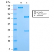 SDS-PAGE analysis of purified, BSA-free Phosphotyrosine antibody (clone PY2870R) as confirmation of integrity and purity.