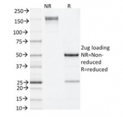 SDS-PAGE analysis of purified, BSA-free IL-4 antibody (clone 11B11) as confirmation of integrity and purity.