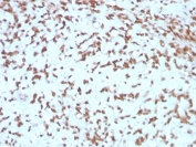 IHC staining of FFPE human liver with CTSD antibody (clone CTSD/3275). HIER: boil tissue sections in pH 9 10mM Tris with 1mM EDTA for 10-20 min and allow to cool before testing.