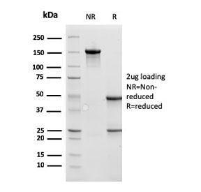 SDS-PAGE analysis of purified, BSA-free CTSD antibody (clone CTSD/3275) as confirmation of integrity and purity.