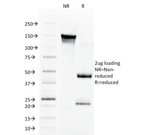 SDS-PAGE analysis of purified, BSA-free Aurora B antibody (clone AURKB/1592) as confirmation of integrity and purity.
