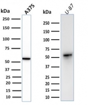 Western blot testing of human A375 and U-87 cell lysate with Vimentin antibody (clone VIM/1937R). Expected molecular weight: 53-58 kDa.