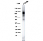 Western blot testing of human spleen lysate with CD11b antibody (clone ITGAM/3338). Expected molecular weight: 127~170 kDa depending on glycosylation level.