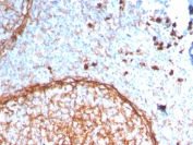 IHC staining of FFPE human tonsil with CD11b antibody (clone ITGAM/3338). HIER: boil tissue sections in pH 9 10mM Tris with 1mM EDTA for 20 min and allow to cool before testing.