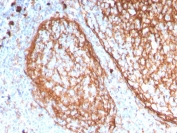 IHC staining of FFPE human tonsil with CD11b antibody (clone ITGAM/3338). HIER: boil tissue sections in pH 9 10mM Tris with 1mM EDTA for 20 min and allow to cool before testing.