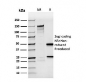SDS-PAGE analysis of purified, BSA-free recombinant BrdU antibody (clone rBRD494) as confirmation of integrity and purity.