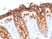 CEA Antibody Colon IHC. Immunohistochemistry analysis of CEA / CEACAM5 expression in FFPE human colon tissue using recombinant CEA antibody, clone C66/3707R. This CEA antibody shows strong apical membranous and cytoplasmic HRP-DAB brown staining in columnar epithelial cells lining intestinal glands, with minimal staining in the surrounding stroma; nuclei are counterstained blue. The staining pattern is consistent with polarized epithelial localization of carcinoembryonic antigen in normal colon tissue. Antigen retrieval was performed by boiling sections in 10 mM Tris buffer with 1 mM EDTA, pH 9, for 20 min followed by cooling at room temperature.