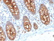 CEA Antibody Human Colon Tissue IHC. Immunohistochemistry analysis of CEA / CEACAM5 expression in FFPE human colon tissue using recombinant CEA antibody, clone C66/3707R. This CEA antibody demonstrates strong apical membranous HRP-DAB brown staining in glandular epithelial cells, with luminal accentuation and minimal signal in surrounding stromal cells; nuclei are counterstained blue. The staining pattern reflects polarized localization of carcinoembryonic antigen within intestinal epithelium. Antigen retrieval was performed by boiling sections in 10 mM Tris buffer with 1 mM EDTA, pH 9, for 20 min followed by cooling at room temperature.