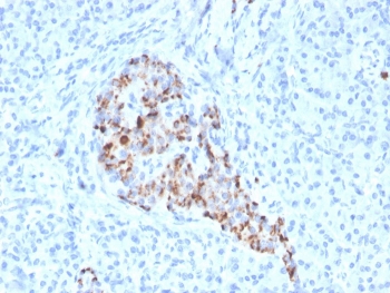 IHC staining of FFPE human pancreas