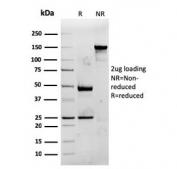 SDS-PAGE analysis of purified, BSA-free recombinant CD74 antibody (clone rCLIP/813) as confirmation of integrity and purity.