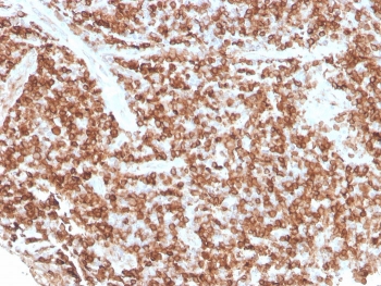 IHC staining of FFPE human tonsil with recombinant CD74 antibody (clone rCLIP/813). HIER: boil tissue sections in pH 9 10mM Tris with 1mM EDTA for 20 min and allow to cool before testing.~