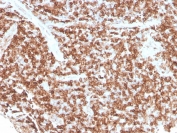 IHC staining of FFPE human tonsil with recombinant CD74 antibody (clone rCLIP/813). HIER: boil tissue sections in pH 9 10mM Tris with 1mM EDTA for 20 min and allow to cool before testing.