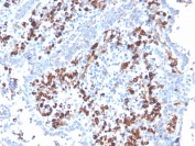 IHC staining of FFPE human tonsil with CD5L antibody (clone CD5L/2991). HIER: boil tissue sections in pH 9 10mM Tris with 1mM EDTA for 20 min and allow to cool before testing.