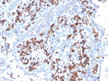 IHC staining of FFPE human tonsil with CD5L antibody. HIER: boil tissue sections in pH 9 10mM Tris with 1mM EDTA for 20 min and allow to cool before testing.