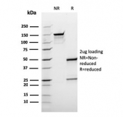 SDS-PAGE analysis of purified, BSA-free BCL10 antibody (clone rBL10/411) as confirmation of integrity and purity.