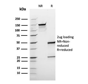 SDS-PAGE analysis of purified, BSA-free BCL10 antibody (clone rBL10/411) as confirmation of integrity