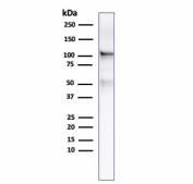 Western blot testing of human LNCaP lysate with FOLH1 antibody. Predicted molecular weight ~100 kDa.