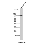 FOLH1 Antibody Human Brain WB. Western blot analysis of human brain tissue lysate using FOLH1 antibody clone FOLH1/3734. A distinct band is detected at approximately 100 kDa, consistent with the expected molecular weight of Folate hydrolase 1 / FOLH1, also known as Prostate-specific membrane antigen / PSMA. The observed signal is consistent with known expression of FOLH1-associated glutamate and folate metabolism pathways within neural tissue environments.