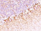 IHC staining of FFPE human cerebellum with Neurofilament antibody cocktail (NF421 + NFL/736). HIER: boil tissue sections in pH6, 10mM citrate buffer, for 20 min and allow to cool before testing.