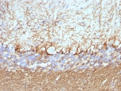 IHC staining of FFPE rat cerebellum with Neurofilament antibody cocktail (NF421 + NFL/736). HIER: boil tissue sections in pH6, 10mM citrate buffer, for 20 min and allow to cool before testing.