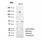 SDS-PAGE analysis of purified, BSA-free A20 antibody (clone TNFAIP3/2813) as confirmation of integrity and purity.