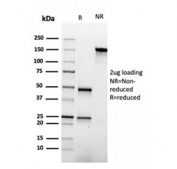 SDS-PAGE analysis of purified, BSA-free APOA1 antibody as confirmation of integrity and purity.