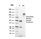 SDS-PAGE analysis of purified, BSA-free Cytokeratin 6B antibody (clone KRT6B/2116) as confirmation of integrity and purity.