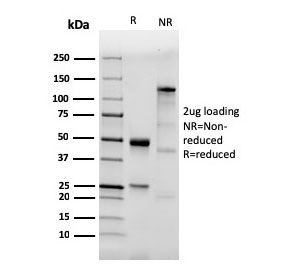 SDS-PAGE analysis of purified, BSA-free recombinant TLR2 antibody (clone TLR2/3894R) as confirmation of integrity and purity.