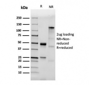 SDS-PAGE analysis of purified, BSA-free recombinant TLR2 antibody (clone TLR2/3894R) as confirmation of integrity and purity.