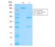 SDS-PAGE analysis of purified, BSA-free recombinant CD162 antibody (clone rPSGL1/1601) as confirmation of integrity and purity.