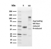 SDS-PAGE analysis of purified, BSA-free recombinant CD45 antibody (clone PTPRC/3881R) as confirmation of integrity and purity.