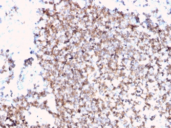 IHC staining of FFPE human tonsil with recombinant CD45 antibody (clone PTPRC/3881R). HIER: boil tissue sections in pH 9 10mM Tris with 1mM EDTA for 20 min and allow to cool before testing.~