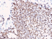 IHC staining of FFPE human tonsil with recombinant CD45 antibody (clone PTPRC/3881R). HIER: boil tissue sections in pH 9 10mM Tris with 1mM EDTA for 20 min and allow to cool before testing.