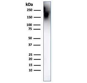 Western blot testing of human spleen lysate with CD45 antibody. Expected molecular weight: 147-220 k