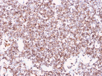 IHC staining of FFPE human tonsil with recombinant CD45 antibody (clone rPTPRC/1461). HIER: boil tissue sections in pH 9 10mM Tris with 1mM EDTA for 20 min and allow to cool before testing.~