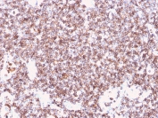 IHC staining of FFPE human tonsil with recombinant CD45 antibody (clone rPTPRC/1461). HIER: boil tissue sections in pH 9 10mM Tris with 1mM EDTA for 20 min and allow to cool before testing.