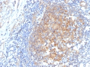 IHC staining of FFPE human tonsil with ARK1C1 antibody. HIER: boil tissue sections in pH 9 10mM Tris with 1mM EDTA for 20 min and allow to cool before testing.