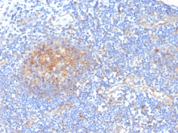 IHC staining of FFPE human tonsil with ARK1C1 antibody. HIER: boil tissue sections in pH 9 10mM Tris with 1mM EDTA for 20 min and allow to cool before testing.~