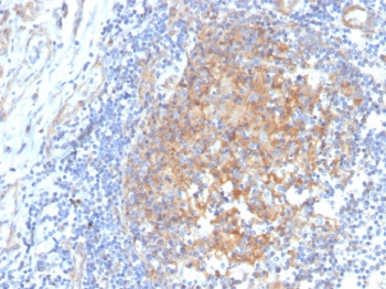 IHC staining of FFPE human tonsil with ARK1C1 antibody. HIER: boil tissue se