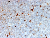 IHC staining of FFPE human lymph node with OX40 antibody. HIER: boil tissue sections in pH 9 10mM Tris with 1mM EDTA for 20 min and allow to cool before testing.