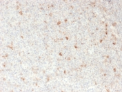 IHC staining of FFPE human lymph node with OX40 antibody. HIER: boil tissue sections in pH 9 10mM Tris with 1mM EDTA for 20 min and allow to cool before testing.