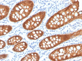 IHC staining of FFPE human colon with recombin